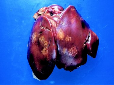 Large, pale areas in the liver of a bird infected with Blackhead (Histomonas meleagridis)